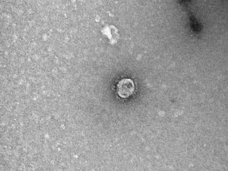 Появились первые фотографии коронавируса