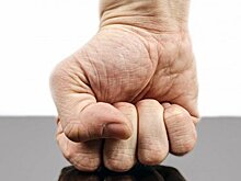 Сломанная челюсть обидчика жены может стоить зареченцу свободы