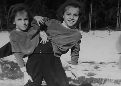 Самые известные сиамские близнецы СССР