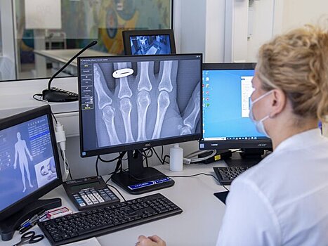 В столице повысили производительность труда врачей-рентгенологов в два раза