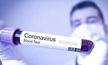 В "Роме" выявили два новых случая коронавируса