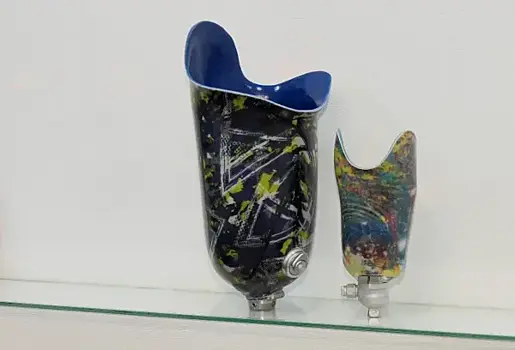 Заново учится ходить: боец СВО Дмитрий Киселев получил современный протез