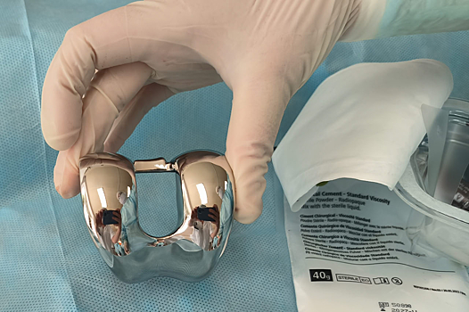 Новокузнецкие врачи впервые заменили кость пациентки на имплант