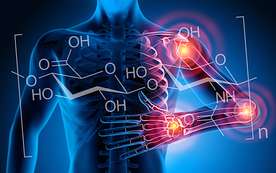 Найден новый способ быстро диагностировать артроз