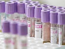 13-летнюю россиянку отстранили за допинг