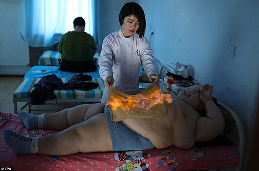 11-летний китаец весом 150 килограммов пытается похудеть с помощью огня