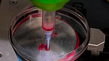 Российские специалисты провели уникальную операцию по 3D-печати тканей кожных покровов на теле пациента