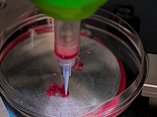 Российские специалисты провели уникальную операцию по 3D-печати тканей кожных покровов на теле пациента