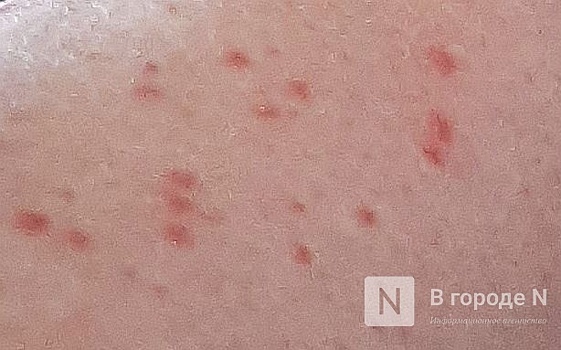 Нижегородцев предупредили о нашествии комаров