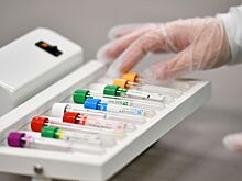 Минпромторг обсуждает расширение перечня маркируемых медицинских изделий