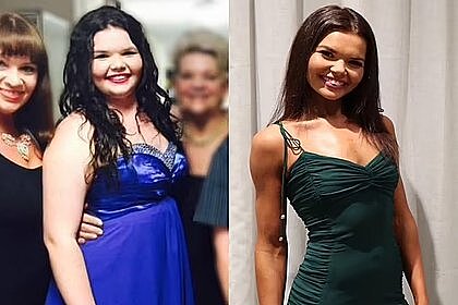 Женщина похудела на 40 килограммов и поделилась опытом