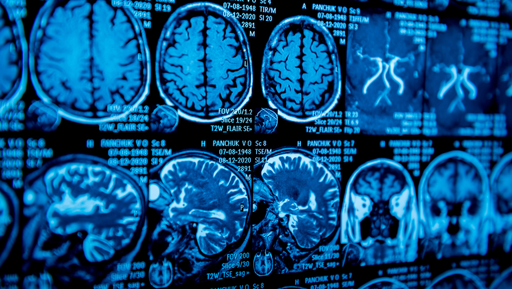 Мозг разных людей обрабатывает цвета одинаково, показала фМРТ