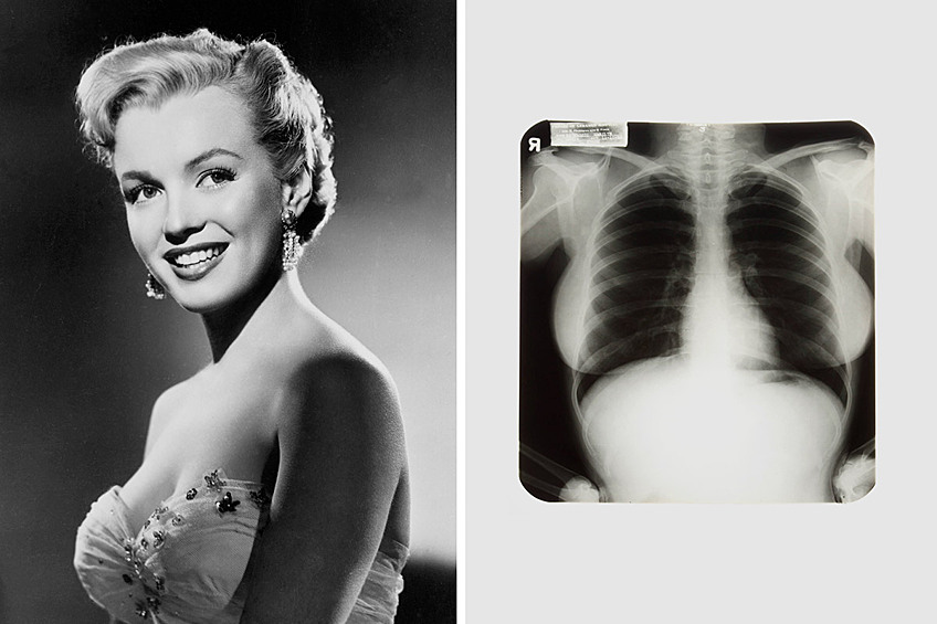 Рентген Мэрилин Монро, $45 000. В 2010 году на аукционе в Лас-Вегасе были проданы три снимка грудной клетки актрисы, сделанные в одной из клиник Флориды во время обследования секс-дивы. Стартовая цена лота составляла всего $3000. 