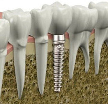 Эксперты повышают безопасность стоматологических процедур