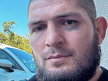 Хабиб опубликовал фото с синяком под глазом