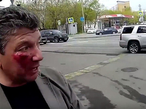 «Он ударил локтем»: активист «СтопХам» рассказал о нападении районного депутата