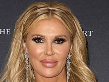 Хирург описал новую внешность известной модели Брэнди Глэнвилл