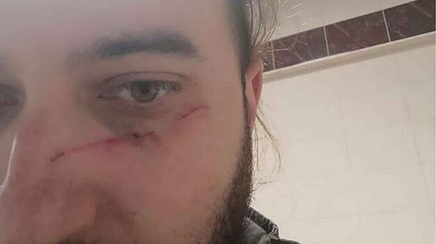 Избитый на курсах «Бастион» журналист ответил на обзывательства главреда «МК» Гусева
