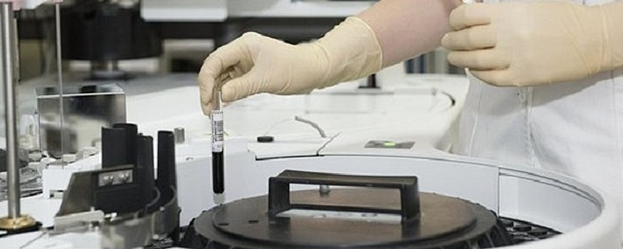 В Карелии обещали за два дня решить проблему с тестами на COVID-19