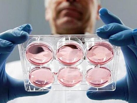 Шизофрению теперь можно определять у эмбрионов