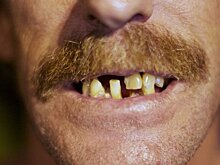 Определен решающий фактор здоровья зубов