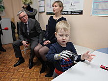 Специалисты "Сколково" устанавливают напечатанные на 3D-принтере протезы