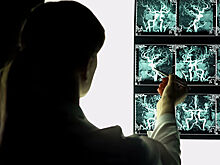 Под Воронежем уволили лаборанта, которая не смогла сделать рентген ребенку