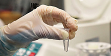 В Москве удвоят количество тестов на коронавирус в сутки