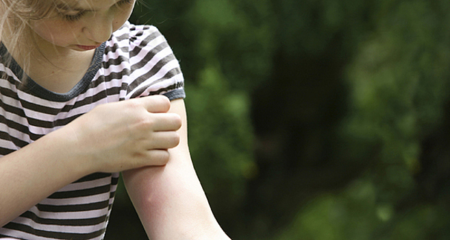 Как защитить ребёнка от комаров (и что делать, если его покусали)