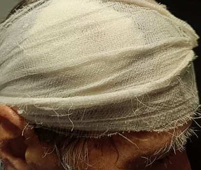 Головой о бетонный столб: пенсионер попал в больницу после встречи с неадекватом в Краснодаре