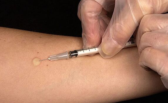 В Таганроге судебные приставы заставили больного туберкулезом пройти лечение