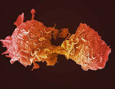Выявлены новые мутации, вызывающие рак