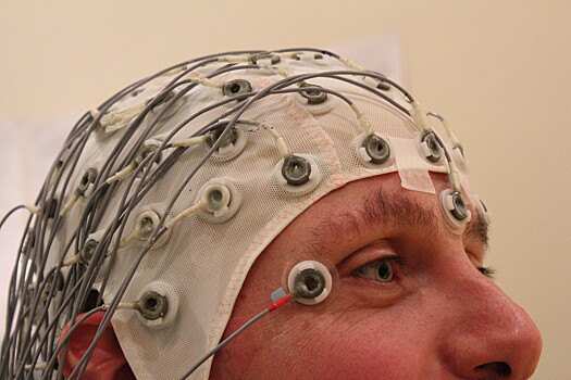 Работу мозгового барьера научились оценивать без томографии