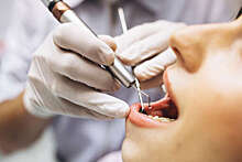 Стоматолог рассказала о мифе про боль при удалении зуба под анестетиком