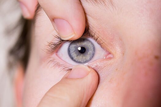 Нужно ли обращаться к врачу при покраснении глаз