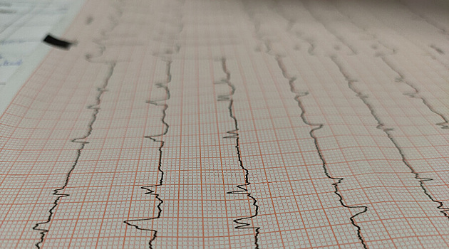 Болевая точка в районе сердца: указывает ли это на инфаркт?