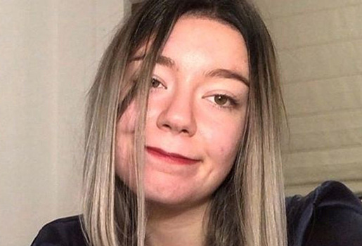 Девушка захотела обновить цвет волос и проснулась с головой размером с футбольный мяч