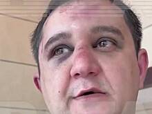 Ломали уши пистолетом: Щепихин рассказал, что с ним якобы делали чеченцы