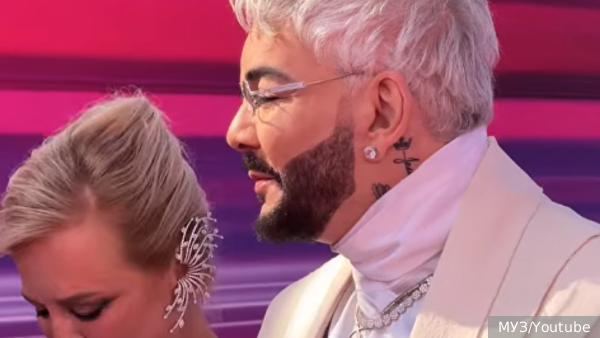 Киркоров назвал себя «фениксом» в связи с восстановлением после ожога