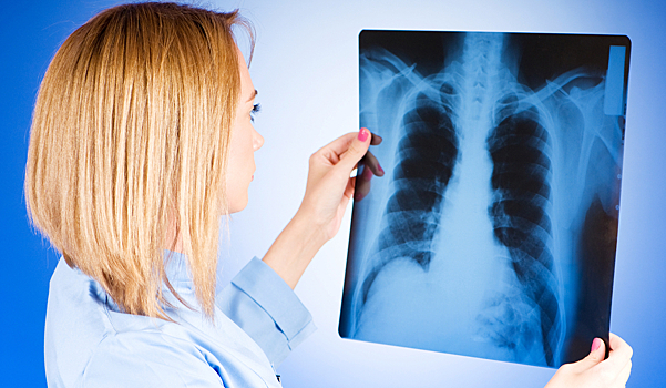 ФПИ разработал комплекс диагностирования рака легких по выдыхаемому воздуху