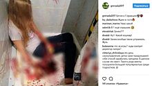Родители возмущены "кровавой" фотосессией детей в красноярском лагере