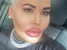 Двойник Ким Кардашьян в два раза увеличил нижнюю губу