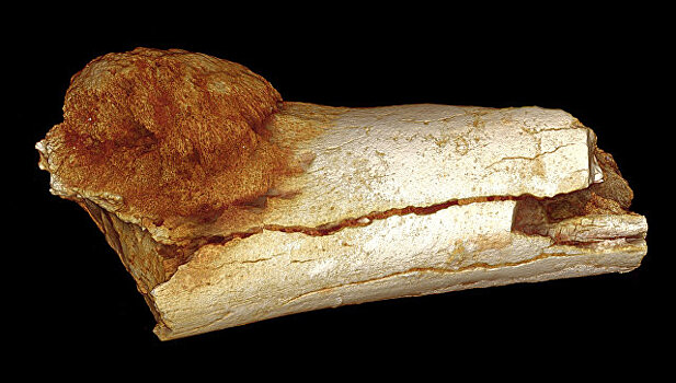 Ученые нашли больного раком, который жил 1,7 млн лет назад