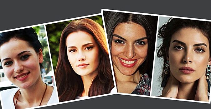 Красота не от природы: известные турецкие актрисы, которые делали пластику