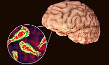 Обнаружена амеба пожирающая мозг человека
