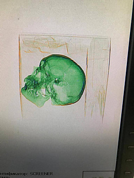 Московские таможенники обнаружили череп в посылке, отправленной в США