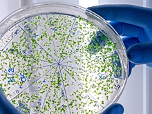 Названы виды рака, которые могут развиться после новогодних праздников