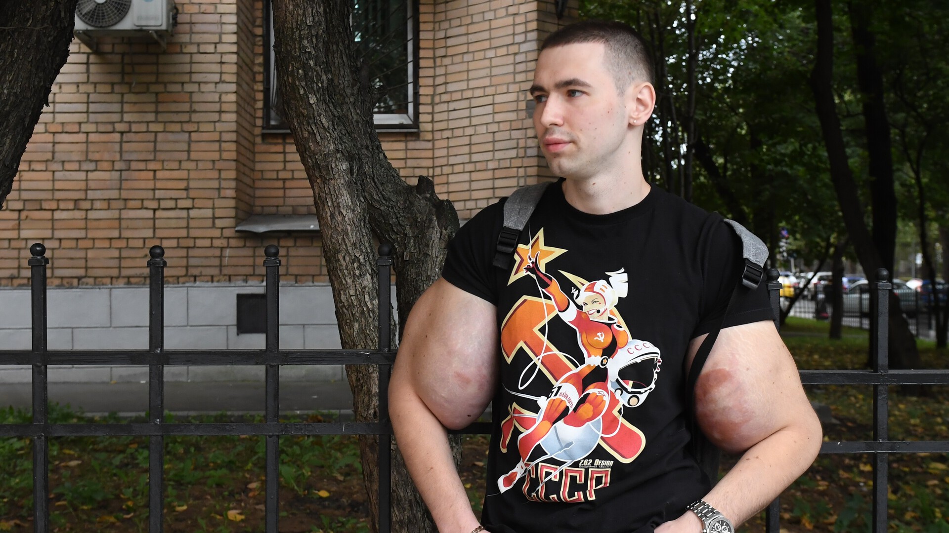 Удастся ли спасти руки-базуки Кирилла Терешина