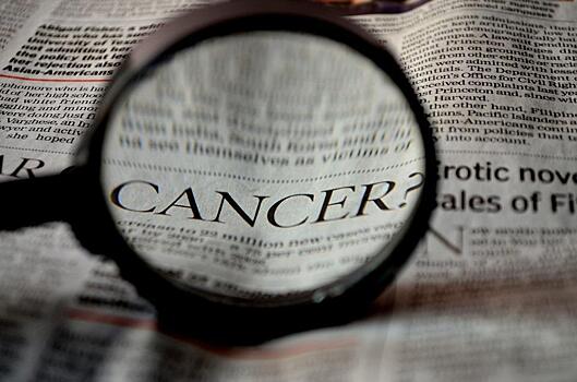 Названы симптомы рака, которые появляются за 5 лет до болезни