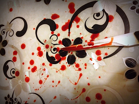 В Подмосковье мужчина ударил тринадцатилетнего подростка ножом в живот